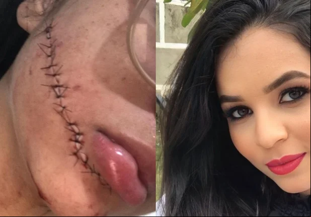 Jovem depois e antes do ocorrido